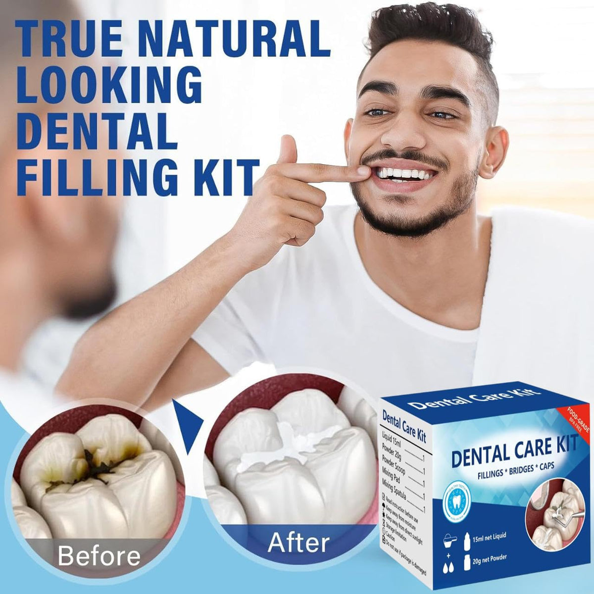 Temporary Teeth Replacement Zinc Oxide Eugenol Dental Kit 4 Pcs I761